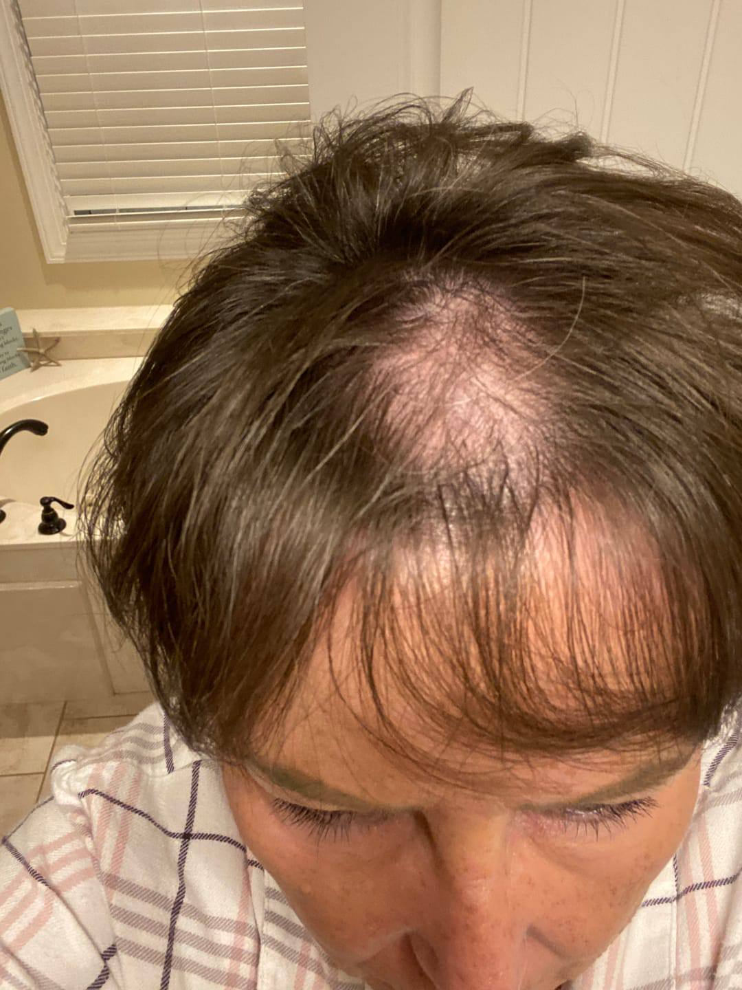 Pamela W. review of Bello Hair Helper Spray image 1 out of 1